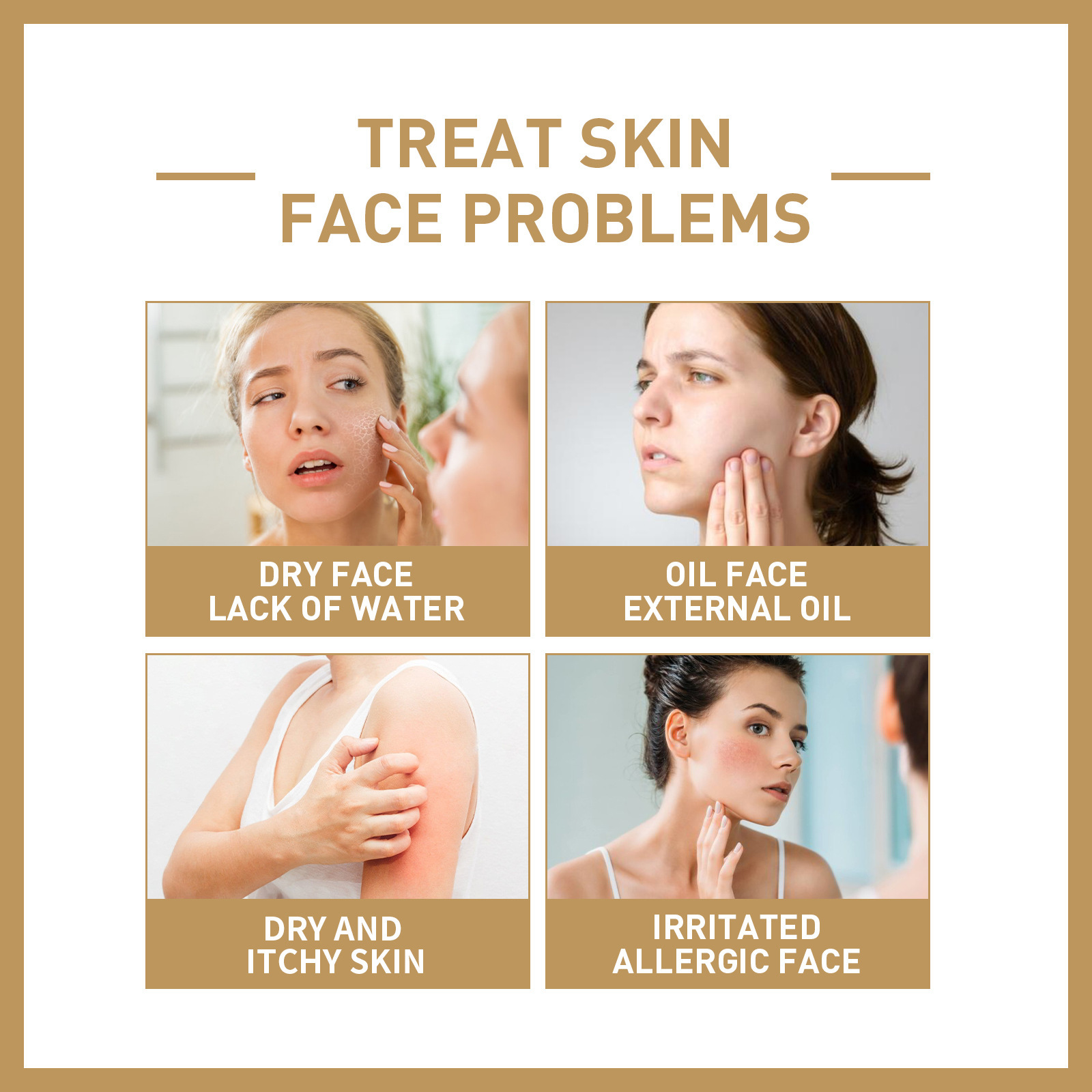 Eelhoe Rice Sensitive Facial N - đánh giá và giá Skincare Oily Skin