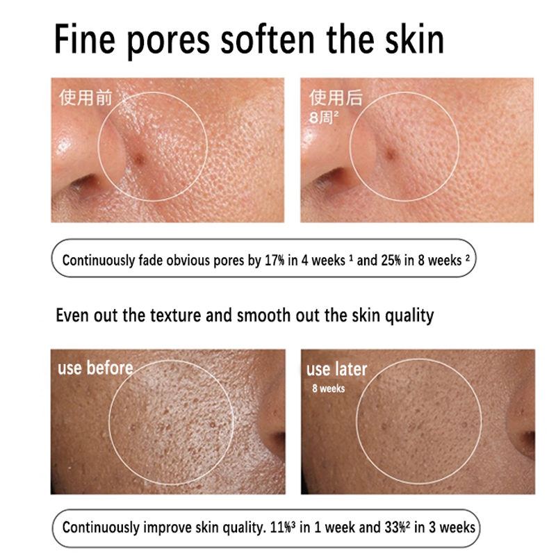 Aloe 2% + NAG 2% Solution Seru - đánh giá và giá Alpha Arbutin Serum
