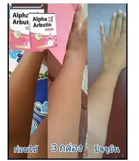 Alpha Arbutin 3 Plus Powder Mi - đánh giá và giá Alpha Arbutin Serum