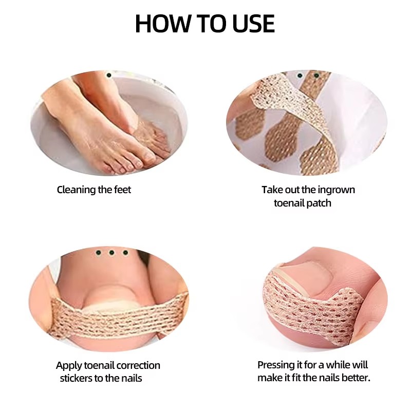 10-100Pcs Adhesive Toenail Pat - đánh giá và giá Skincare Oily Skin