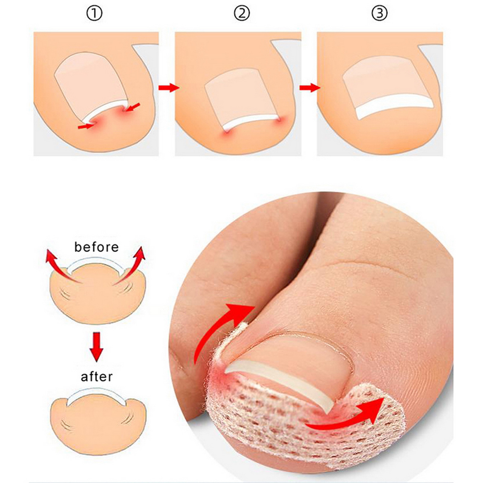 10-100Pcs Adhesive Toenail Pat - đánh giá và giá Skincare Oily Skin